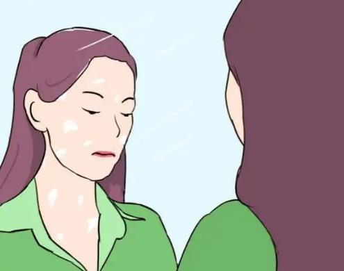 女性白癜风治疗的方法