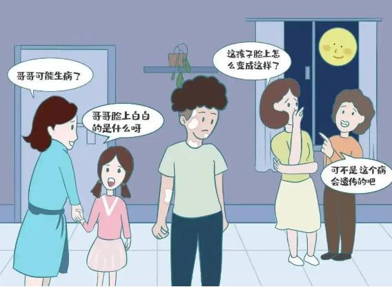 青少年白斑治愈后容易复发吗